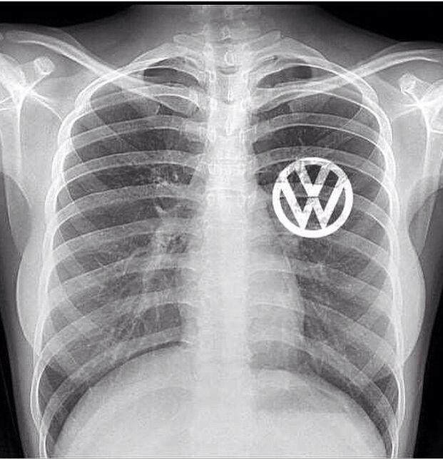 Radiographie-Thorax-Coeur-VW